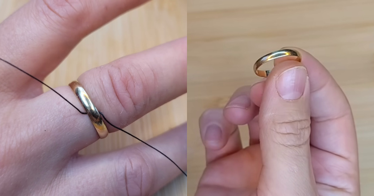 How to Remove a Ring Stuck on Finger